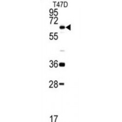 DEAD Box Polypeptide 5 (DDX5) Antibody