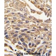 Arylsulfatase B (ARSB) Antibody