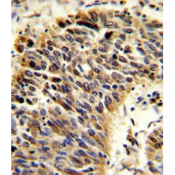 Vitronectin (VTN) Antibody