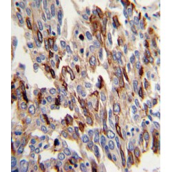 Platelet And Endothelial Cell Adhesion Molecule 1 (PECAM1) Antibody