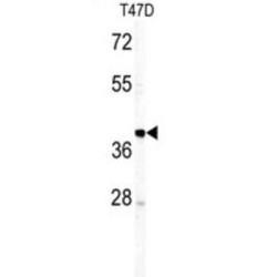 Immunoglobulin M (IgM) Antibody