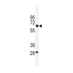 Pyruvate Kinase PKM (PKM1) Antibody
