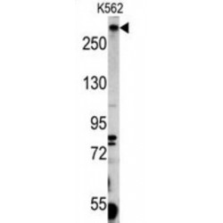 Pericentriolar Material 1 Protein (PCM-1) Antibody