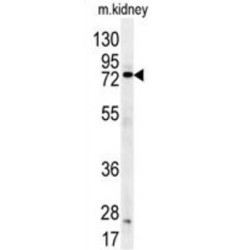 DEAD-Box Helicase 53 (DDX53) Antibody