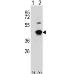 Glycine C-Acetyltransferase (GCAT) Antibody