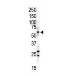 Mitogen-Activated Protein Kinase 8 / JNK1 (MAPK8) Antibody