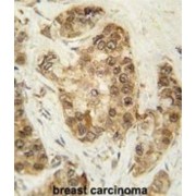 Cyclin-Dependent Kinase 2 (CDK2) Antibody