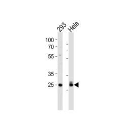 Cyclin-Dependent Kinase 2 (CDK2) Antibody