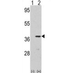 Cyclin-Dependent Kinase 3 (CDK3) Antibody