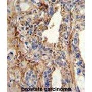 Cyclin-Dependent Kinase 4 (CDK4) Antibody