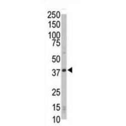 Cyclin-Dependent Kinase 4 (CDK4) Antibody