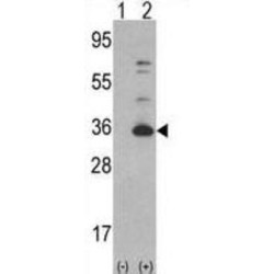 Cyclin-Dependent Kinase 4 (CDK4) Antibody