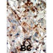 Cyclin Dependent Kinase Inhibitor 3 (CDKN3) Antibody