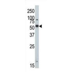 Dual Specificity Tyrosine-Phosphorylation-Regulated Kinase 2 (DYRK2) Antibody