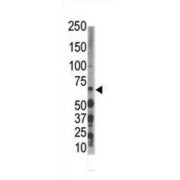 Dual Specificity Tyrosine-Phosphorylation-Regulated Kinase 3 (DYRK3) Antibody
