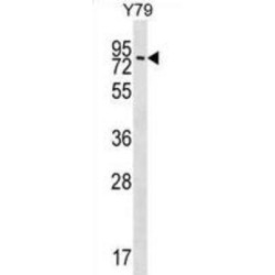 Serine/threonine-Protein Kinase MAK (MAK) Antibody