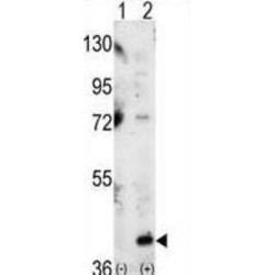 Mitogen-Activated Protein Kinase 14 (MAPK14) Antibody