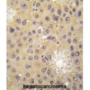 Acetyl Coenzyme A Acetyltransferase 1 (ACAT1) Antibody