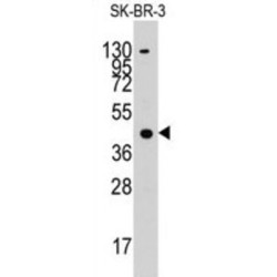 Acetyl Coenzyme A Acetyltransferase 1 (ACAT1) Antibody