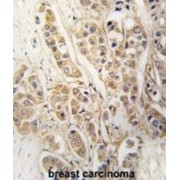 Chloride Intracellular Channel Protein 4 (CLIC4) Antibody