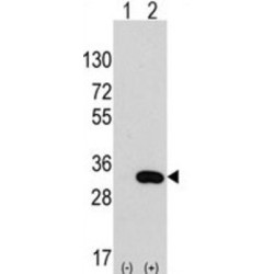 Chloride Intracellular Channel Protein 4 (CLIC4) Antibody