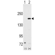 Steroid Receptor Coactivator 1 (SRC1) Antibody