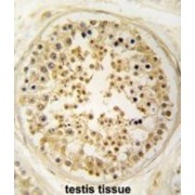 Probable Glutamate-tRNA Ligase, Mitochondrial (EARS2) Antibody