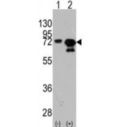 HSPA1A / HSPA1B Antibody