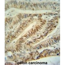 Cullin 5 (CUL5) Antibody