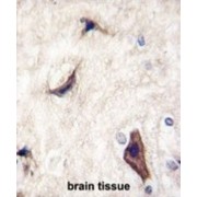 Ras-Specific Guanine Nucleotide-Releasing Factor 1 (RASGRF1) Antibody