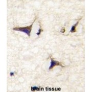 Disheveled Associated Activator of Morphogenesis 2 (DAAM2) Antibody