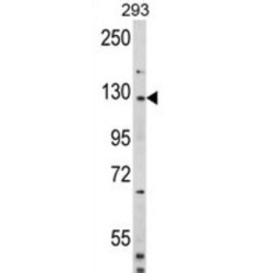 Disheveled Associated Activator of Morphogenesis 2 (DAAM2) Antibody