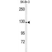 Aminopeptidase N (ANPEP) Antibody