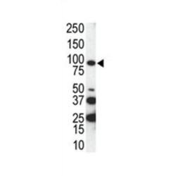 Tyrosine-Protein Kinase Receptor UFO (AXL) Antibody