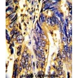 Tyrosine-Protein Kinase Receptor UFO (AXL) Antibody