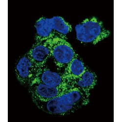 Macrophage Colony-Stimulating Factor 1 Receptor (CSF1R) Antibody