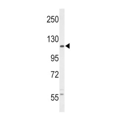 Macrophage Colony-Stimulating Factor 1 Receptor (CSF1R) Antibody