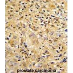 Lumican (LUM) Antibody