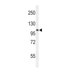 EPH Receptor A2 (EphA2) Antibody