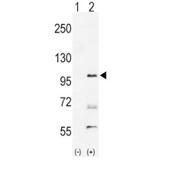EPH Receptor A2 (EphA2) Antibody