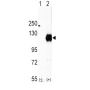 EPH Receptor A2 (EphA2) Antibody