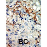 EPH Receptor A3 (EphA3) Antibody