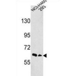 EPH Receptor A3 (EphA3) Antibody
