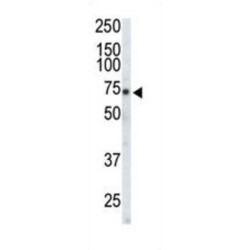 EPH Receptor A3 (EphA3) Antibody