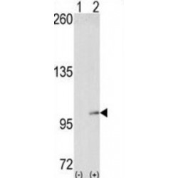 EPH Receptor A4 (EphA4) Antibody