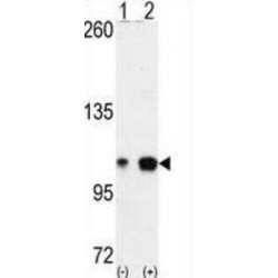EPH Receptor A4 (EphA4) Antibody