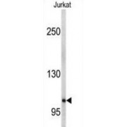 WB analysis of Jurkat cell lysates, using EphA5 antibody.