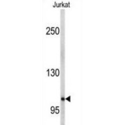 WB analysis of Jurkat cell lysates, using EphA5 antibody.