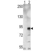 Ephrin Type A Receptor 5 (EphA5) Antibody