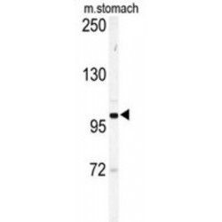 Eph Receptor A6 (EPHA6) Antibody